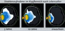 Strahlenaufnahme im Kopfbereich