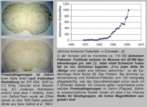 Proteinablagerungen